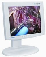 NDS Surgical Imaging 90R0004 EndoVue Series 19” High-Definition Medical Imaging LCD Display, Pixel Pitch 0.294 mm, Resolution (H x W) 1280 x 1024 (SXGA), Luminance 350 cd/m2, Contrast Ratio 650:1, Aspect Ratio 5:4, Number of Colors 16.8 Million, Color Gamut 100% (SMPTE 296M, HD Standard), Viewing Angle 178º, Response 10-16 ms (90R-0004 90R 0004) 