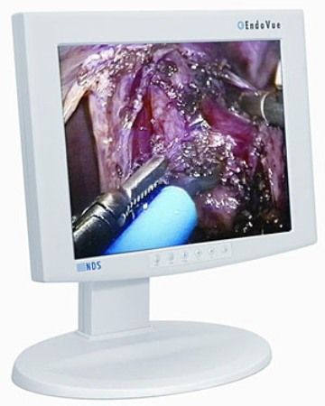 NDS Surgical Imaging 90R0004 EndoVue Series 19 High-Definition Medical Imaging LCD Display, Pixel Pitch 0.294 mm, Resolution (H x W) 1280 x 1024 (SXGA), Luminance 350 cd/m2, Contrast Ratio 650:1, Aspect Ratio 5:4, Number of Colors 16.8 Million, Color Gamut 100% (SMPTE 296M, HD Standard), Viewing Angle 178, Response 10-16 ms (90R-0004 90R 0004)