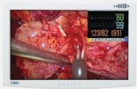 NDS Surgical Imaging 90R0023 Radiance Series 26” High-Definition, Multi-Modality Imaging LCD Display with Fiber Optic Input, Pixel Pitch 0.287 mm, Resolution (H x W) 1920 x 1200 (WUXGA), Luminance 500 cd/m2, Contrast Ratio 800:1, Aspect Ratio 16:10, Number of Colors 16.8 Million, Viewing Angle 178º, Response 5-12 ms (90R-0023 90R 0023) 