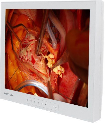 Medvix AMVX1908HD Surgical LCD Display, 19