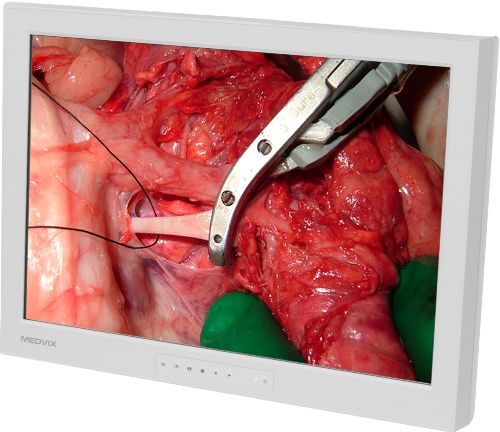 Medvix AMVX2408HD Surgical LCD Display, 24