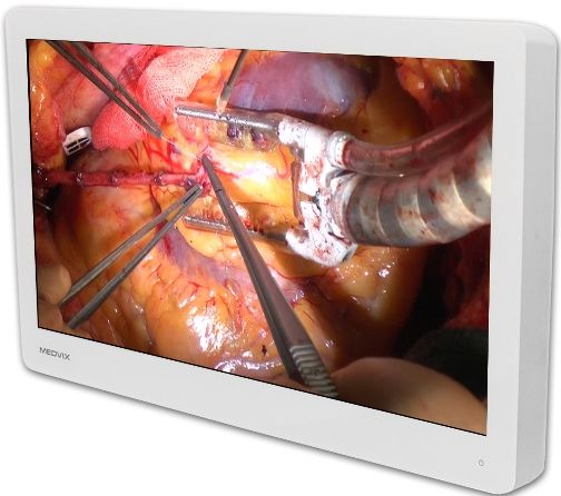 Medvix AMVX2608HD Surgical LCD Display, 26